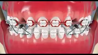 ORTHODONTIE AG&Eacute;N&Eacute;SIE DENTAIRE