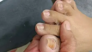 Pedicure Last #satisfying Neldz SOLO Parent  is live!