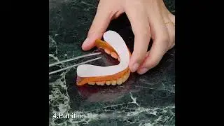 Denture Comfort Redefined 😁  Y Kelin Cushion Pads!