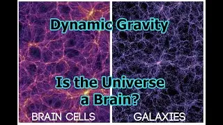 Dynamic Gravity | Is Universe a Brain?