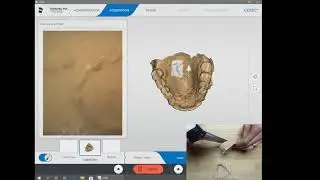 Full Arch Scan with OmniCam