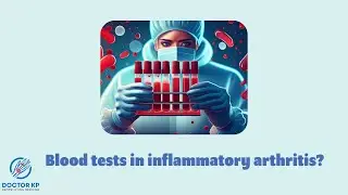 Bloods in inflammatory arthritis