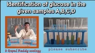 Identification of glucose in the given samples/Glucose test by..Gopal Reddy zoology lab 