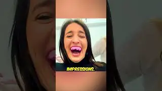🦷 Dental Fail When Impressions Go Wrong