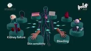 Awareness Film: Cardiac Catheterization - English