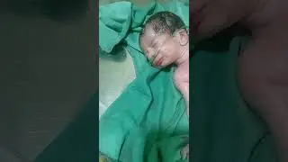 The newborn baby vernix will now be cleaned,and along with that,the umbilical cord will also be cut.