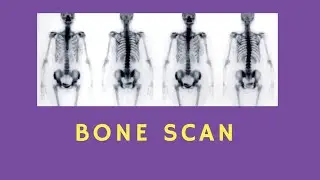 BONE SCAN | RADIOTHERPAY EDUTECH | NUCLEAR MEDICINE