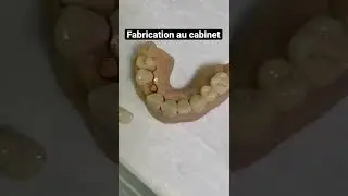 #dentist #chairsidedentistry #emaxcrown #zirconia #digitaldentistry #digitaldesign #dentalimplants