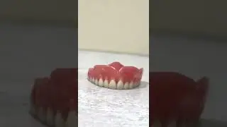 Dentures in a Day! 😁 #bossiercitydentist #teethinaday #crownanddenturesolutions