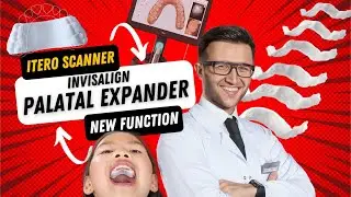 🆕 NEW iTero Function | Invisalign&reg; Palatal Expander 🦷