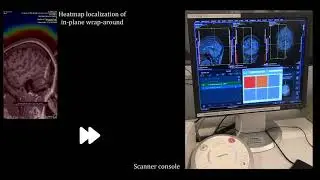 High Precision Imaging with Autonomous MRI (in-plane wrap-around)