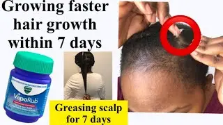 GREASING SCALP Everyday WITH VICKS VAPOUR RUB! 7 DAY CHALLENGE Vicks vapour rub for hair growth
