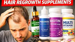 How to regrow male pattern hair loss | hair growth supplements
