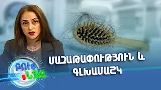 Մազաթափություն և գլխամաշկ / Խորհուրդ մասնագետից / Բուժ ինֆո / Buj Info