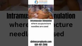 Intramuscular Stimulation & Dry Needling in Langley | Divine Care Physiotherapy Langley BC