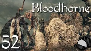 Loran Silverbeast &ndash; Part 52 &ndash;🩸Bloodborne