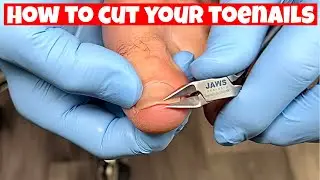 HOW TO TRIM YOUR OWN TOENAILS - (DIY)