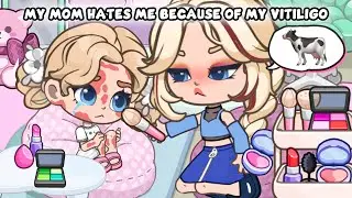 My Mom Hates Me Because of My Vitiligo 😭💔 Sad Story | Dopples World