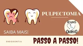 REMOÇÃO DE TODA A POLPA DENTÁRIA!! Saiba + | PULPECTOMIA - Resumos de Odonto
