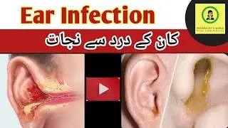 Ear Infection Treatment| ear pain relief| ear pus treatment. #earinfection