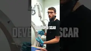Injections for Scar Tissue?