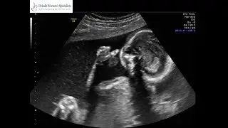 SCARY ANATOMY SCAN !