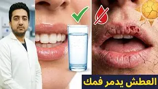 Beware of dehydration &mdash; it causes mouth ulcers
