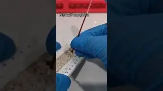 manual hemoglobin using capillary tube