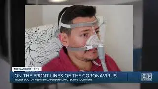 Valley doctor helps build device to make up for PPE shortages