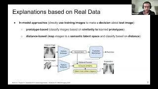 WoXAI - Beyond Heatmaps: Example-based and Concept-Based Explainability for AI in Medical Imaging
