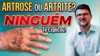 Artrose ou artrite de mão, TUDO que você DEVE saber.
