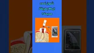 شلون نحدد WL بطريقة صحيحةHow to measure WL accurately using Apex Locator Z#ENDOA2Z#حشوات_الجذور_أ_ي