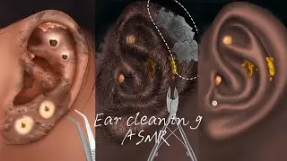 Ear cleaning ASMR 🧽| Ear hair & pus removal👂| Relaxing ASMR 