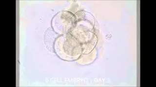 IVF Fertilisation