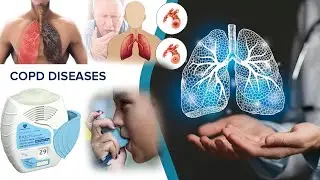 Asthma Symptoms, Treatments, Diagnostics | Ellipta device technique | How to use Ellipta inhaler