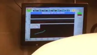 92 Civic VX on Xenocron dyno