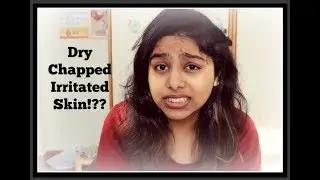 Are you experiencing DRYNESS even after MOISTURIZING?