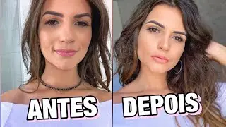 1 mês depois da Rinoplastia e Blefaro! Antes X depois, respondendo as dúvidas