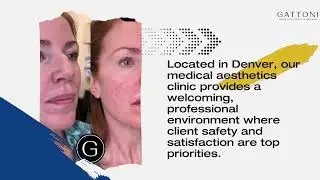 Lip fillers in Denver - Denver Botox GATTONI Medical Aesthetics
