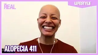 Alopecia 411