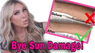 2 Steps to ERASE SUN DAMAGE, HYPERPIGMENTATION on Your Body AT-HOME!