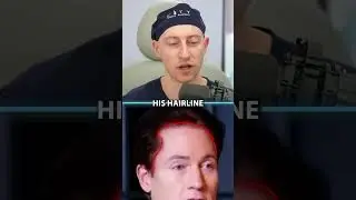 Hair Surgeon Reacts To Bryan Johnson Reveals How He Reverses Hair Loss