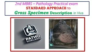 2nd MBBS Pathology Practical Exam | Standard Approach to Gross Specimen Description | Viva Guide