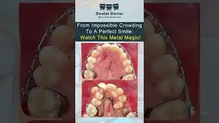 Best Dentist in Multan/ Best Dental Clinic in Multan