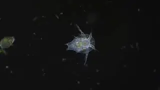 Imagen al microscopio de campo oscuro de varios protozoos (5)