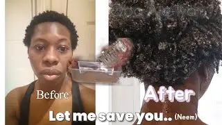 This Neem Powder Will Save Your Hair. |Oba Aje-Iya