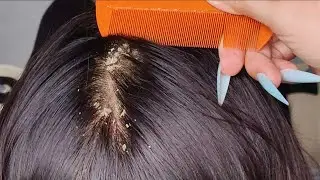 💖 ASMR Hair Care Routine & Scalp Check | Long Nails, Soft Brushing & Tingly Mic Sounds #DN561