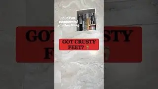 Byeee Crusty Feet: ULTIMATE CRACKED HEEL REMOVAL! Pedicure Foot File Transformation [2024]