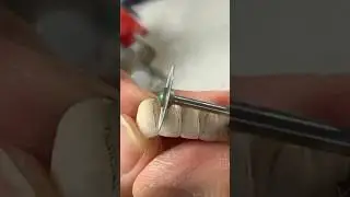 Contouring a Bridge vs. Contouring Crowns