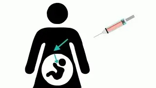 Example Preemie Prep for Parents Video About Antenatal Corticosteroids